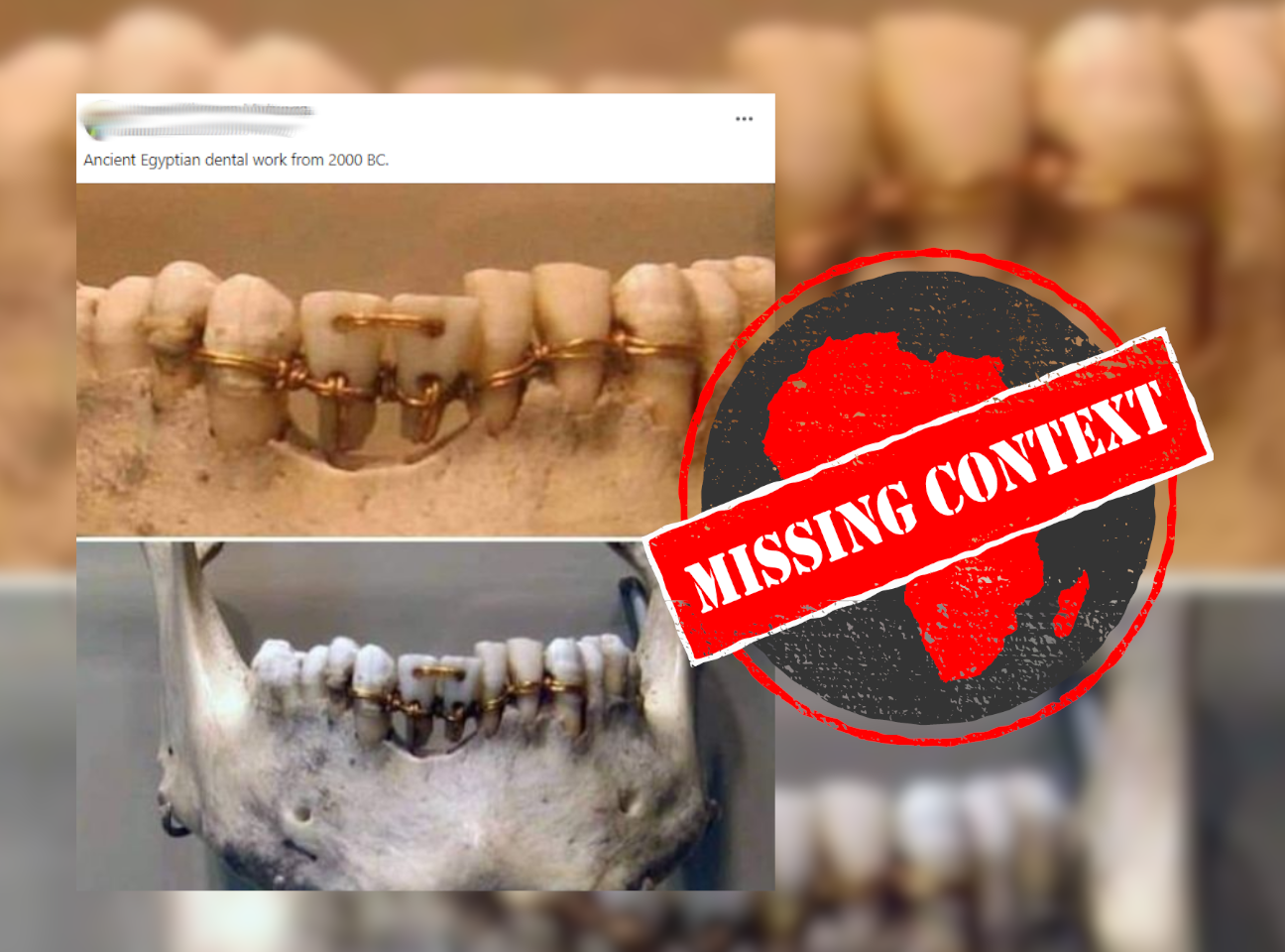 Dental_MissingContext