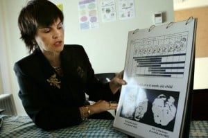 Leana Olivier, head of the Foundation for Alcohol Related Research (FARR), shown in 2007 explaining to a reporter the effects of Foetal Alcohol Syndrome on the developing brain of a child. Photo AFP/Gianluigi Guercia