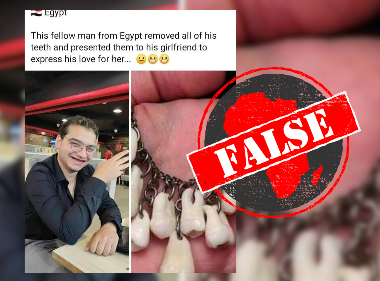 EgyptTeeth_False