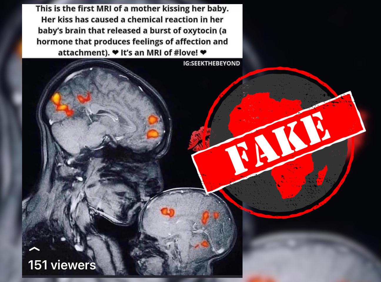 MRI_Fake
