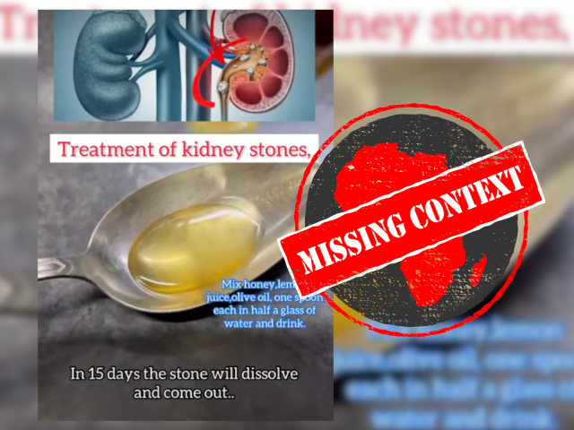 KidneyStones_MContext