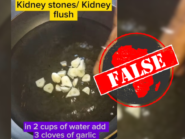 KidneyStones_False
